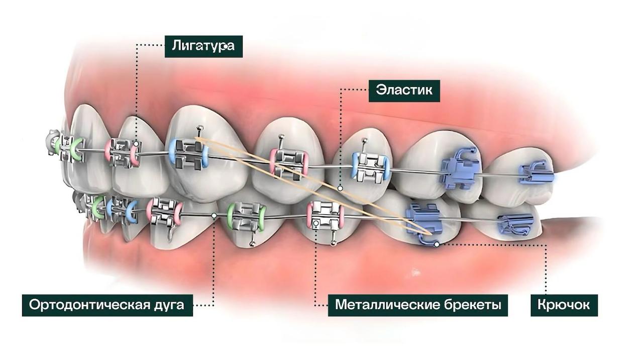 Формирователь десны
